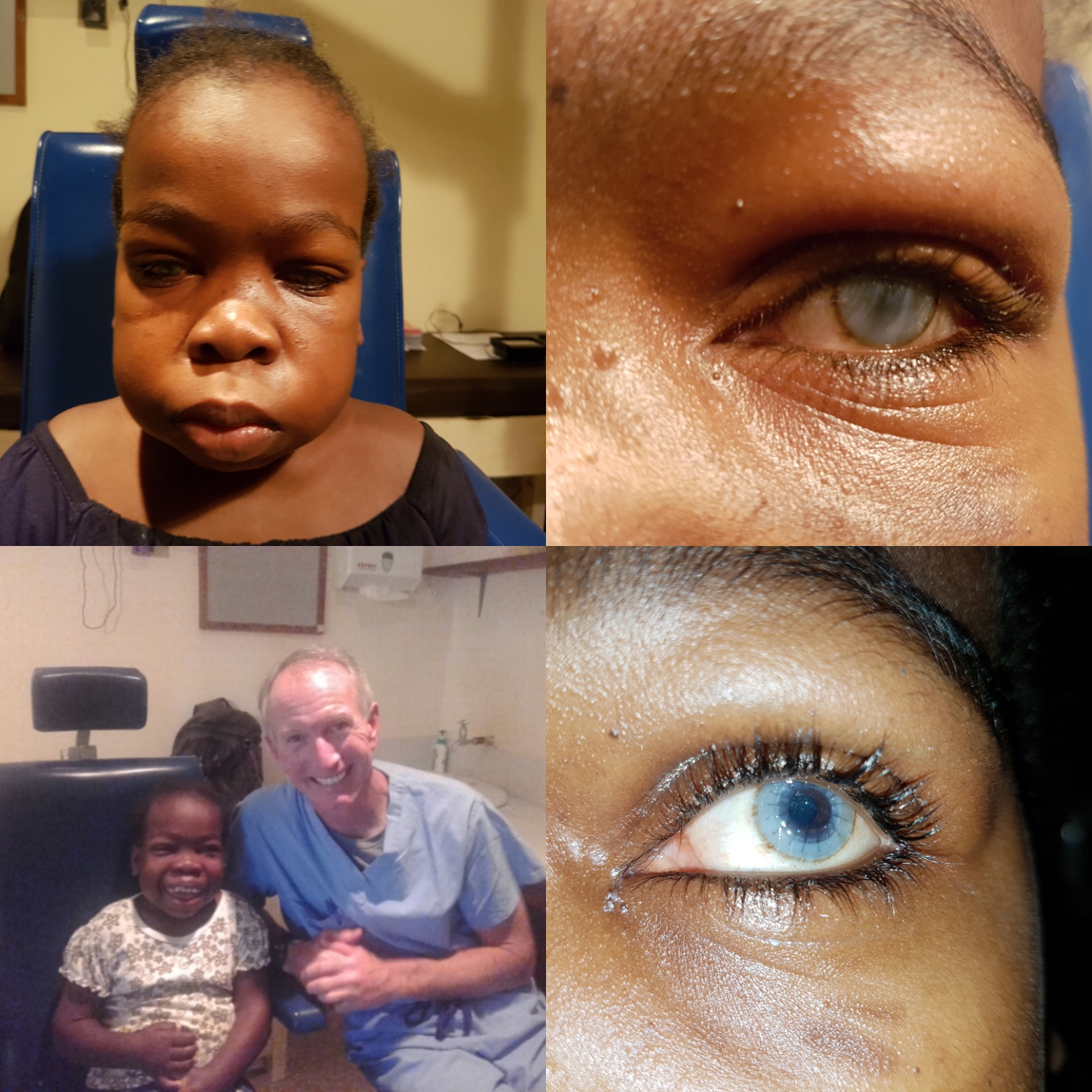 Dr. James Brooks and Eye Bank team up to support the Lighthouse